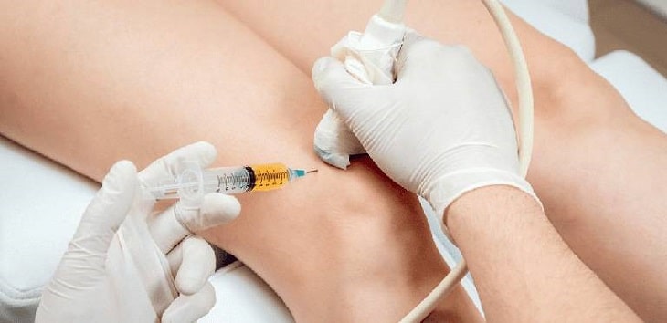 Dược phẩm bổ sung chất nhờn cho khớp gối hiệu quả 2022