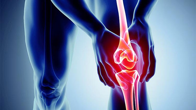 Tìm hiểu phác đồ điều trị viêm khớp gối hiệu quả hiện nay