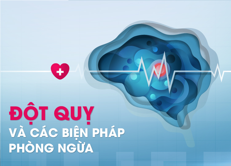 Cách phòng ngừa đột quỵ - Các biện pháp hiệu quả để giảm nguy cơ đột quỵ