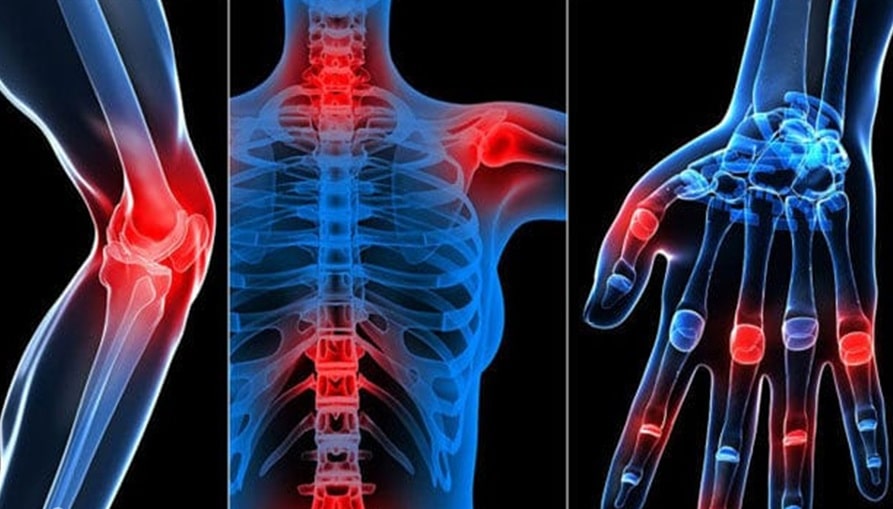 Viêm khớp có nguy hiểm không và cách điều trị