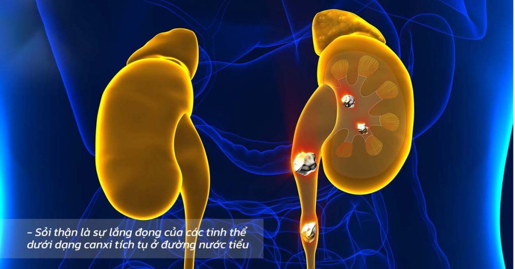 Sỏi Thận Hình Thành Như Thế Nào? Bệnh Có Nguy Hiểm Không?