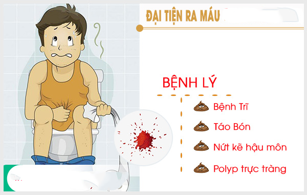 Người mắc bệnh trĩ nên ăn uống như thế nào?